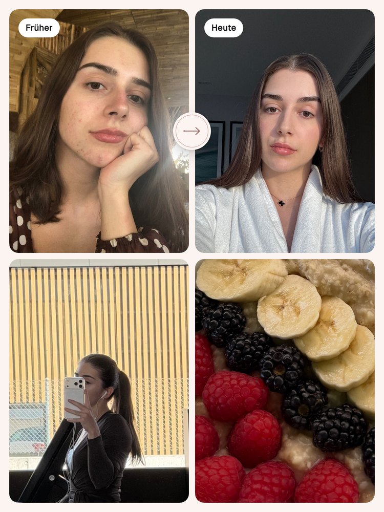 Emira früher mit Akne und heute, dazu beim Training und ein Frühstück mit Haferbrei und Beeren.