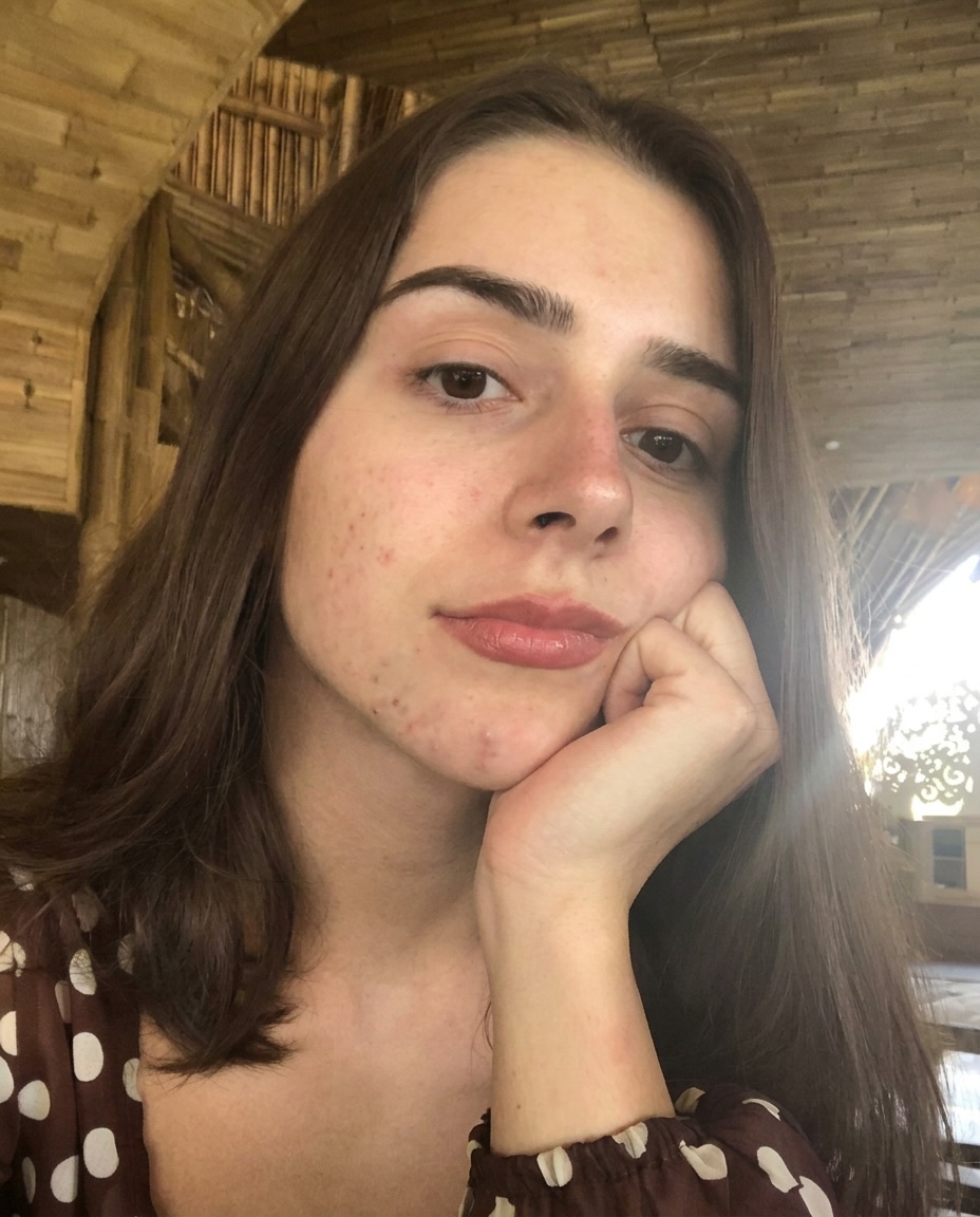Emira damals